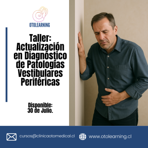 Taller: Actualización patológias vestibulares perifericas